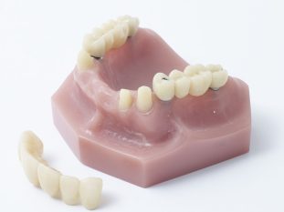 Dentadura-3-2