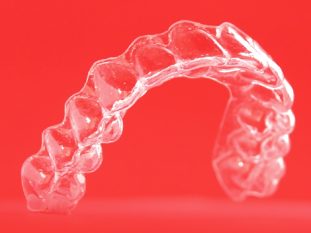 alineadent