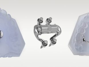 super-hybrid-y-expander